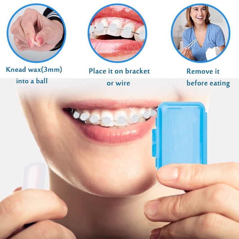 01 Sáp nha khoa, sáp chỉnh nha vị trái cây cho người niềng răng