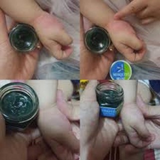 [SALE GỐC] DẦU THOA TRỊ MUỖI ĐỐT THÁI LAN