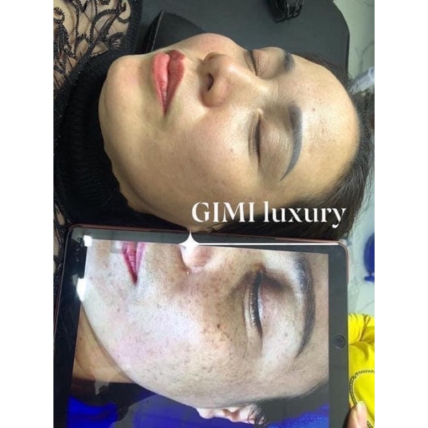 Bộ Kem Nám GiMi Luxury Chính Hãng Mẫu Mới Nhất