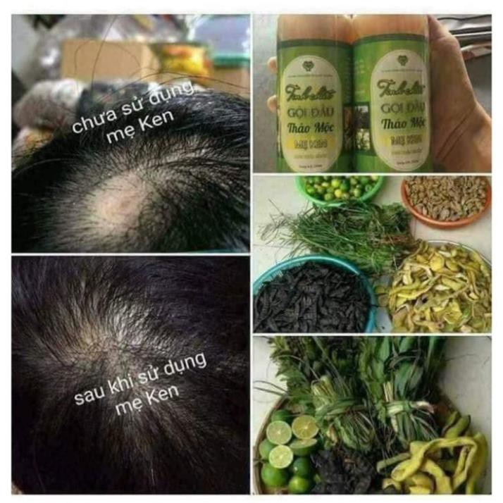 [Chính hãng] Dầu gội thảo mộc MẸ KEN-Dầu Gội Thảo Mộc chiết xuất thiên nhiên 100%- 250ml | BigBuy360 - bigbuy360.vn