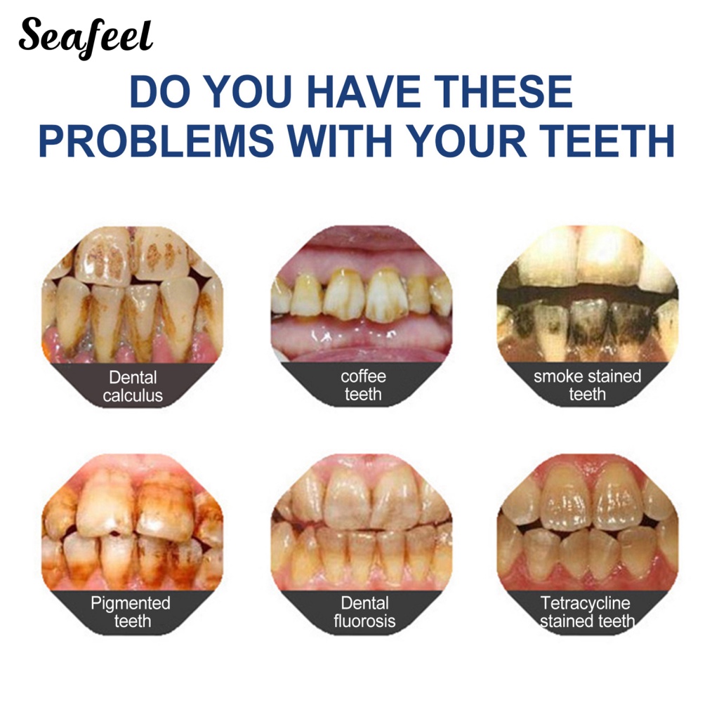 Sf_dây Sơn Trắng Răng Gọn Nhẹ Làm Trắng Răng Miệng