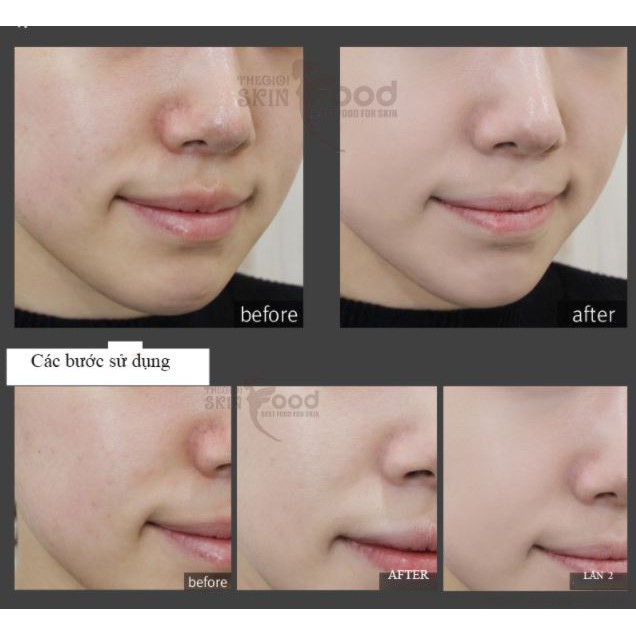 Phấn Nước Che Phủ Tốt, Dưỡng Ẩm Cho Lớp Nền Hoàn Hảo Aprilskin Magic Snow Cushion Galaxy Edition SPF50+/PA+++ 15g | BigBuy360 - bigbuy360.vn