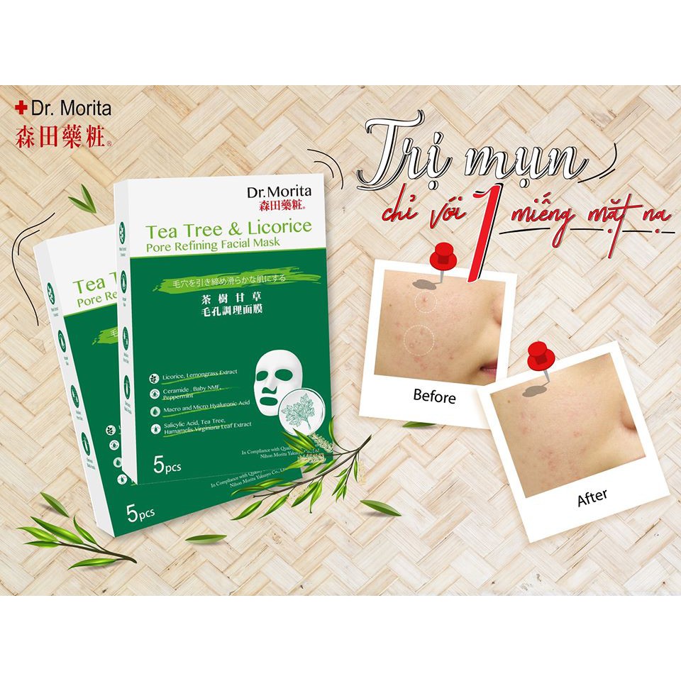 Combo 5 Mặt Nạ Giảm Mụn, Kiềm Dầu Dr. Morita Tea Tree &amp; Licorice Pore Refining Facial Mask 30g x 5