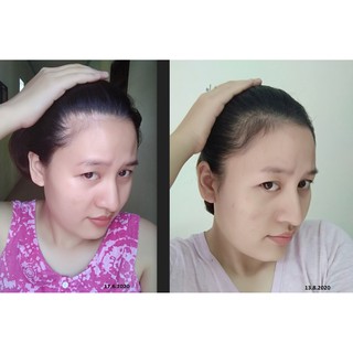 Dầu gội kích thích mọc tóc thảo dược THT