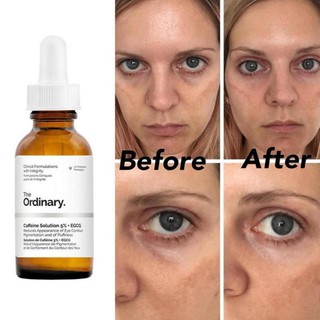 [NHẬP KHẨU 2021] Tinh Chất The Ordinary Caffeine Solution 5% + EGCG ( 30mL )