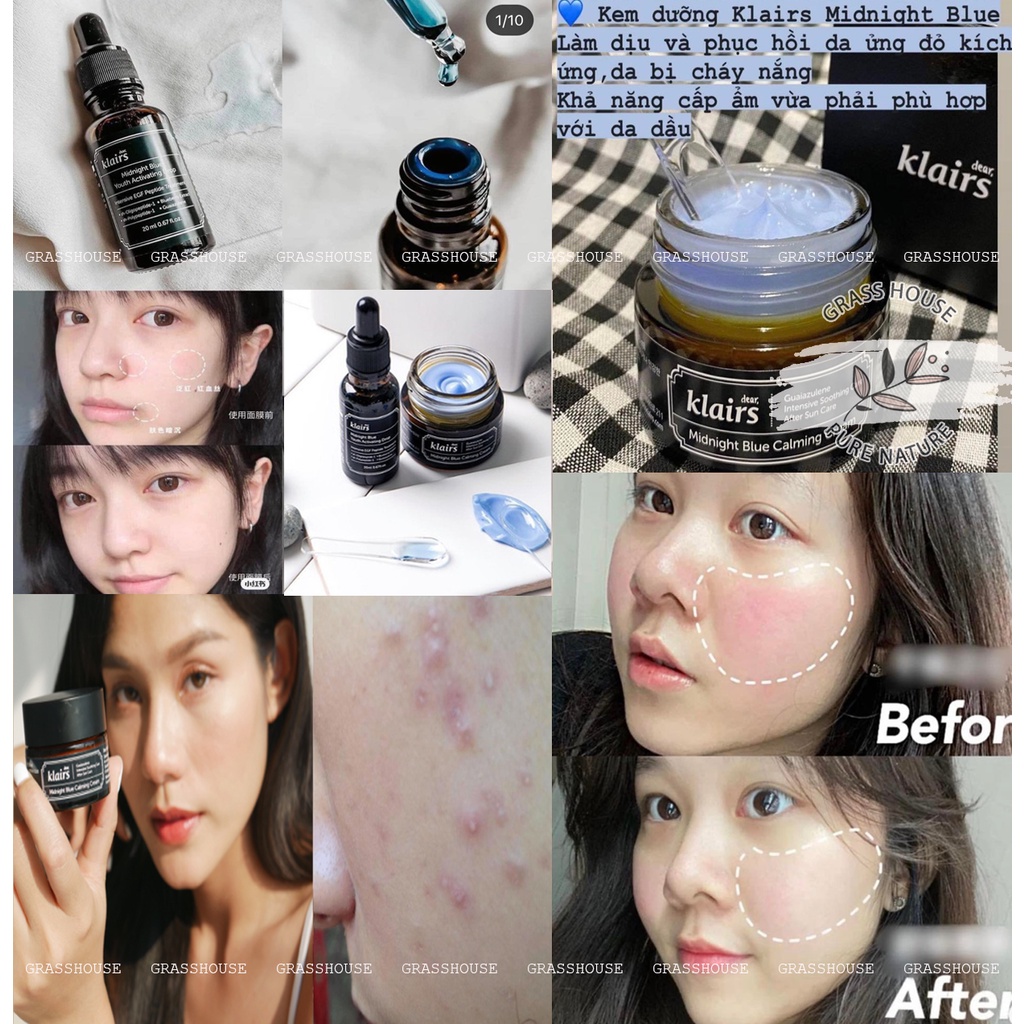 TRỌN BỘ KEM DƯỠNG KLAIRS MIDNIGHT BLUE