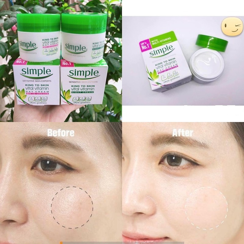 Kem Dưỡng Ẩm Simple Kind To Skin Hydrating Light Moisturiser