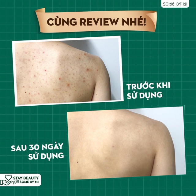 Sữa Tắm Some By Mi Acne Clear Body Cleanser 400ml Nhập Khẩu | WebRaoVat - webraovat.net.vn