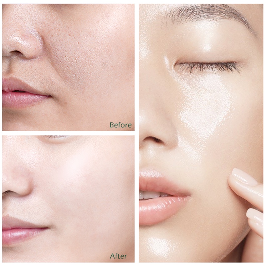 Se Khít Lỗ Chân Lông Kiểm Soát Dầu Chống Lão Hóa Làm Trắng Sáng Da 10ml