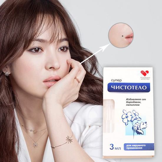 Gel tẩy nốt ruồi mụn cóc mụn thịt mụn cơm mụn ruồi Nga