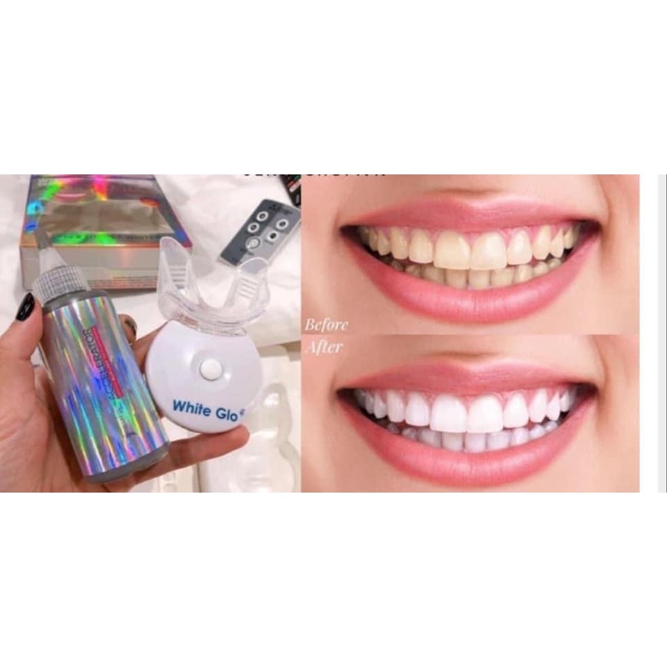 Set Làm Trắng Răng White Glo White Accelerator Blue Light Teeth Whitening System