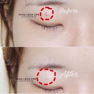 CHE KHUYẾT ĐIỂM NARS tone sáng