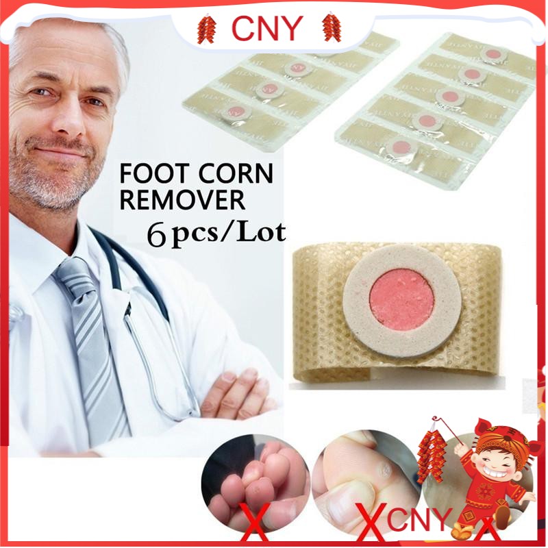 Set 6 miếng dán thạch cao giảm đau vết chai bàn chân bảo vệ chăm sóc chuyên dụng | BigBuy360 - bigbuy360.vn