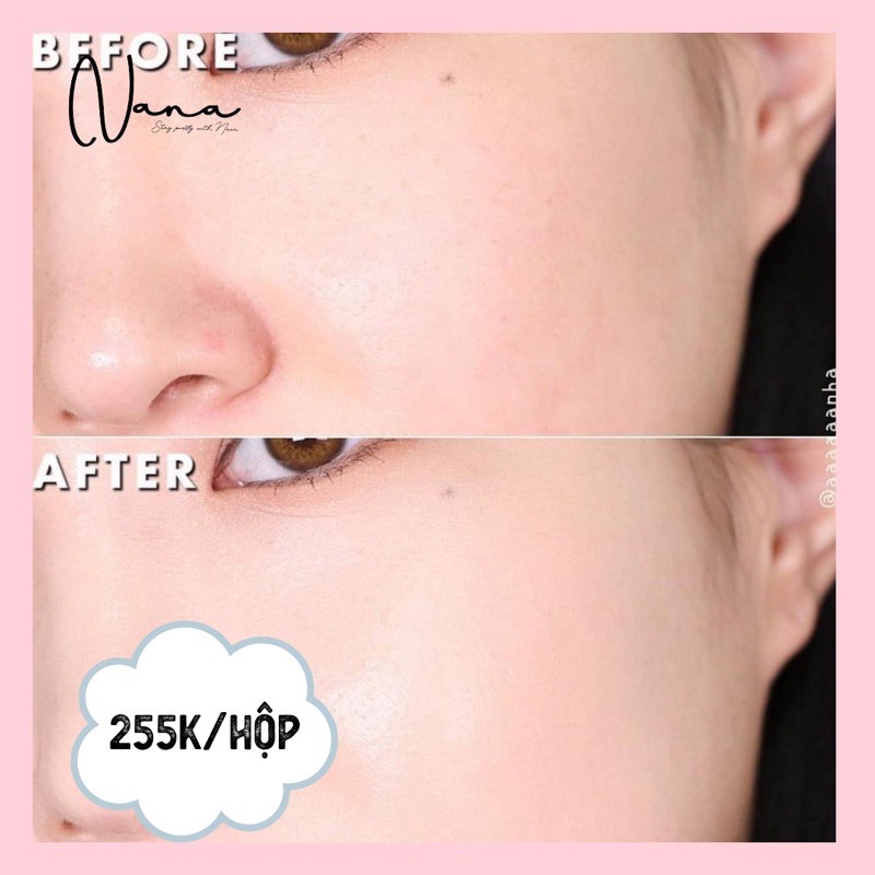 ON SALE SHOCK ( KÈM LÕI THAY THẾ) PHẤN NƯỚC CLIO XP | BigBuy360 - bigbuy360.vn