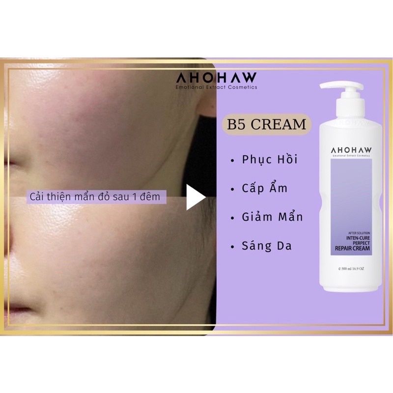 Kem phục hồi da B5 Ahohaw - Perfect Repair Cream
