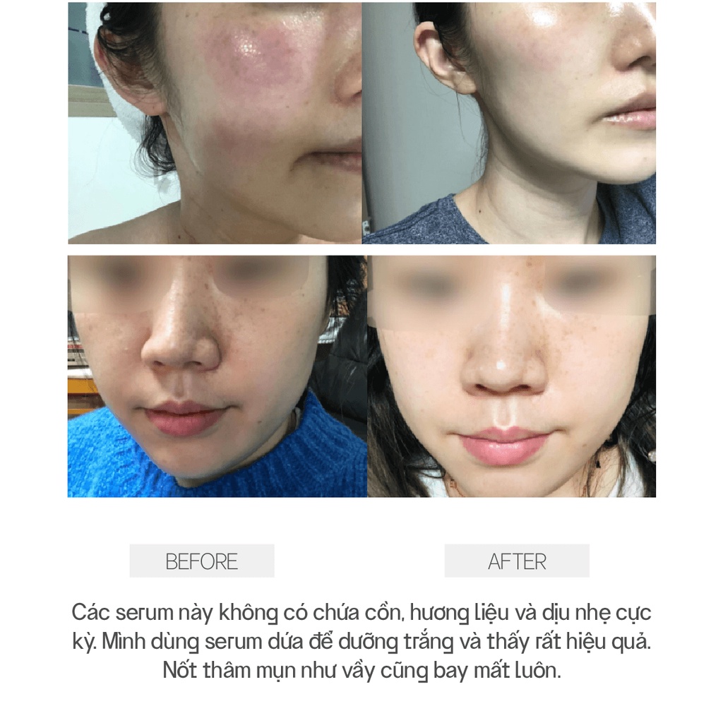 [Qùa Tặng] Combo 3 Tinh Chất Dưỡng Vegick WHITENING SERUM, CALMING SERUM, REPAIRING SERUM, 4.5ml