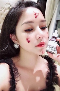 Serum thay da sinh học Red Peel Tingle