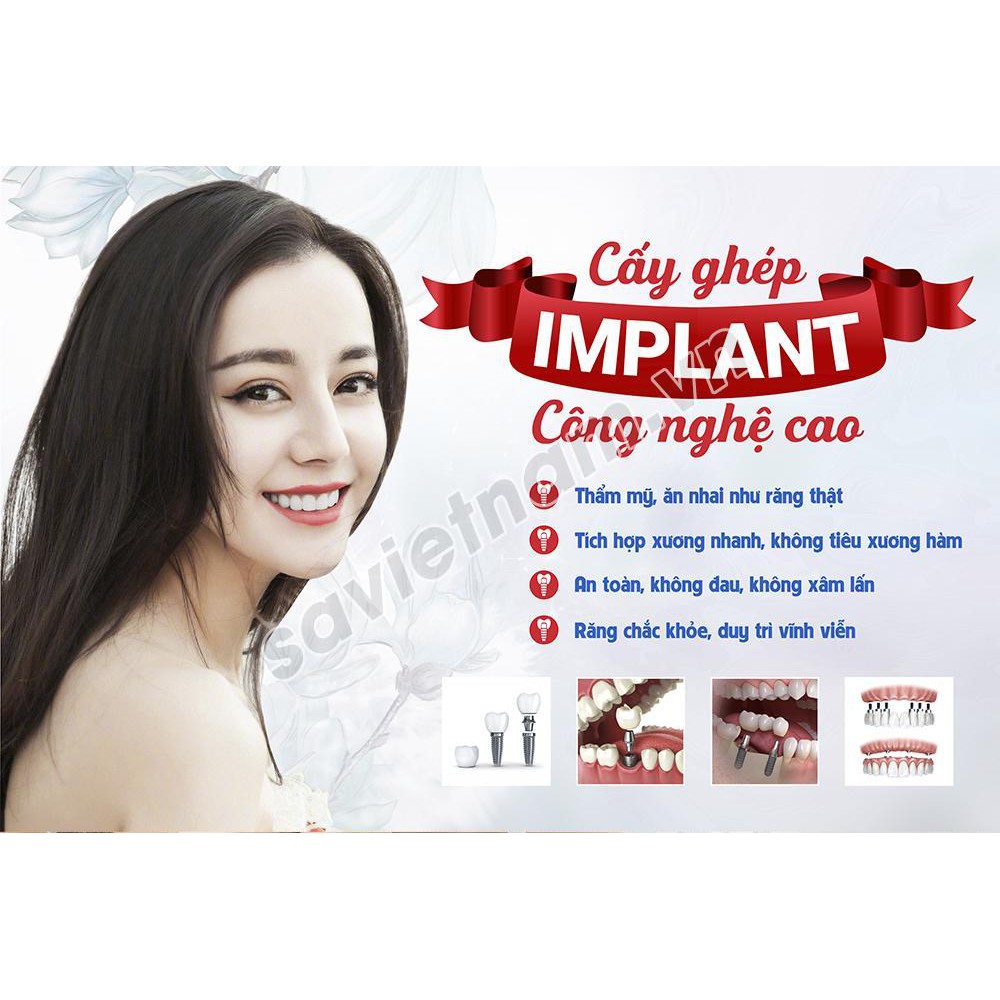 Tranh poster nha khoa tư vấn các chủ đề: răng sứ, implant, chỉnh nha, tẩy trắng,trám răng, ... chất liệu DECAL BÓC DÁN