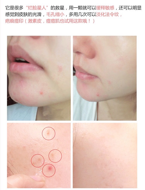 Serum Sụn Mũi Cá Hồi Dds Nội địa Trung