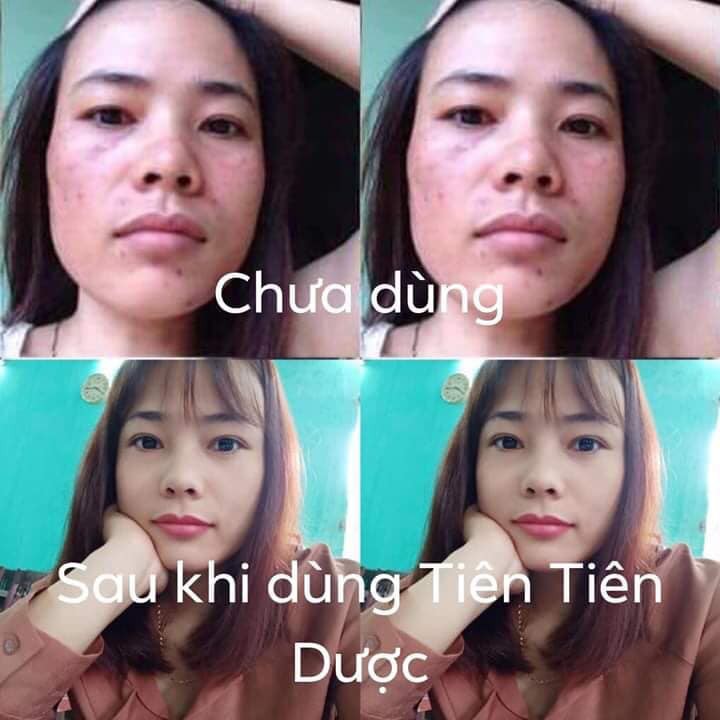 TINH CHẤT TÁI TẠO DA TIÊN TIÊN DƯỢC- HÀNG CHÍNH HÃNG