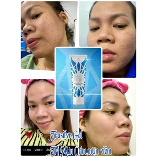 Gel bạc diệt khuẩn TRUSILVR