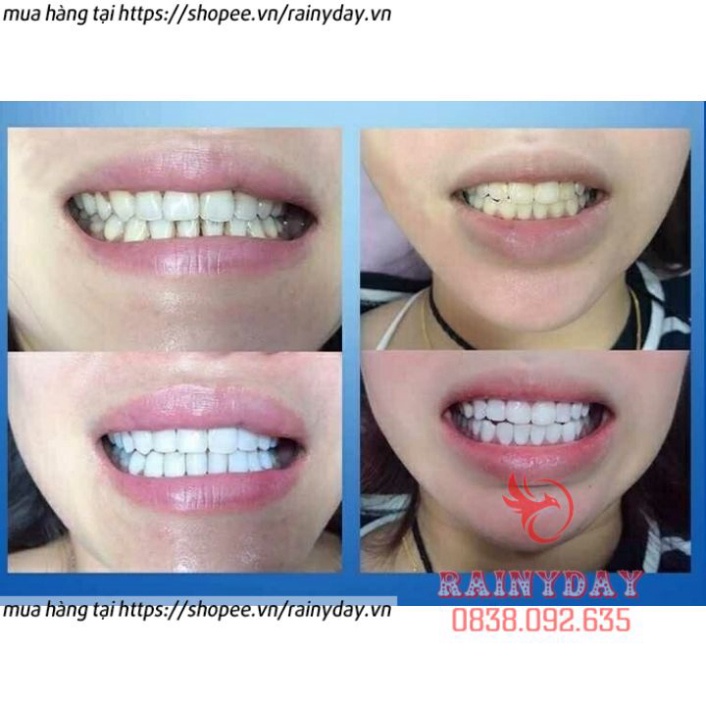 Hộp 14 miếng dán trắng răng tiện lợi 3D White Teeth Whitening Strips dán tẩy trắng răng - 7 gói