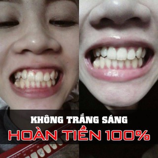 Miếng Dán Làm Trắng Răng Viva White