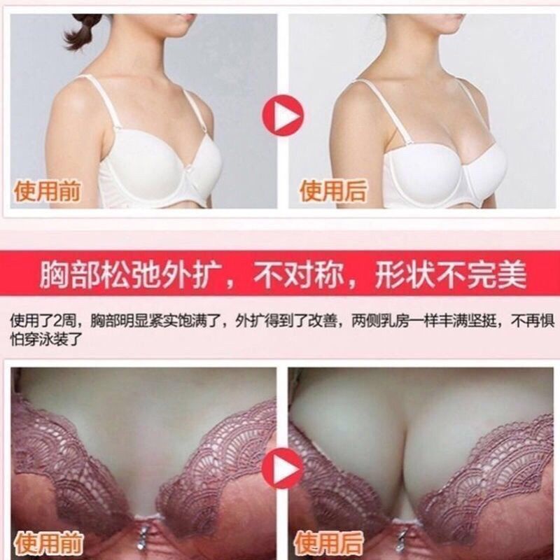 Miếng Dán Nâng Ngực Từ A Đến E pectoralis Chuyên Dụng Giúp Tăng Kích Thước Vòng Một Từ A Đến E Dành Cho Phụ Nữ Sau Sinh Size Lớn 3 11 | BigBuy360 - bigbuy360.vn