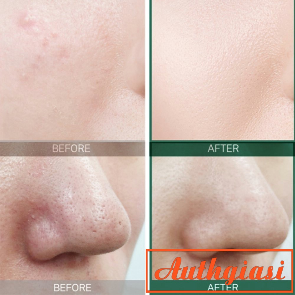 [Sạch mụn chỉ trong 30 ngày] Nước hoa hồng "thần kỳ" Some By Mi AHA-BHA-PHA 30 Days Miracle Toner | BigBuy360 - bigbuy360.vn