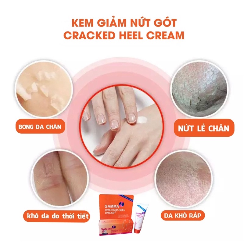 Kem giảm nứt gót chân dưỡng ẩm, dưỡng da chân làm mềm