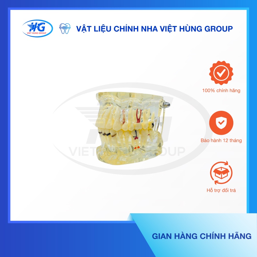 Mẫu Hàm Bệnh Lý Răng Người Lớn A4001-2 DANTER - VIỆT HÙNG GROUP