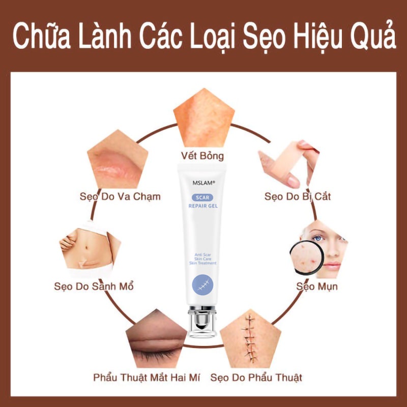 Kem che sẹo Giảm bỏng và bỏng nước Vết thương phẫu thuật v.v.mờ sẹo thâm mụn,mờ thâm ,khổi phục da,Kem chuyên xóa sẹo lồi lâu năm.