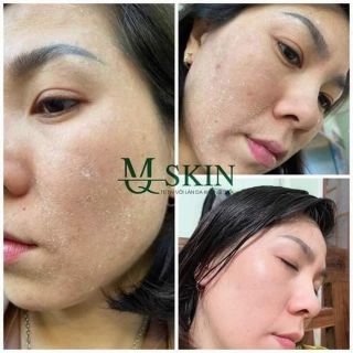 Serum Sâm hoàn hảo