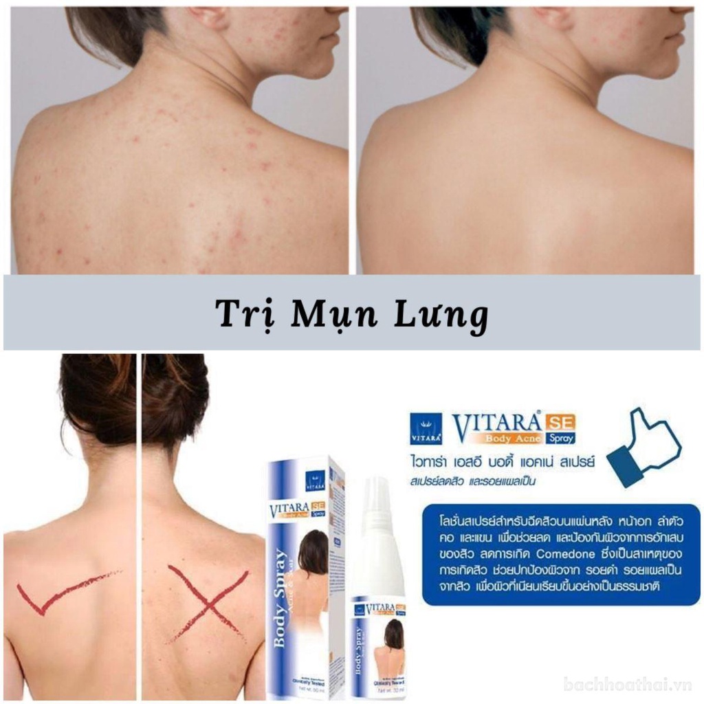 Chai xịt đánh bay mụȵ lưng VITARA SE Body Acne Spray