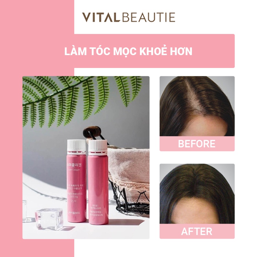 Nước Uống Bổ Sung Collagen Hỗ Trợ Làm Đẹp Và Ngăn Ngừa Lão Hóa Vital Beautie Super Collagen VB (30 Ống) 25 ml/ 1 ống