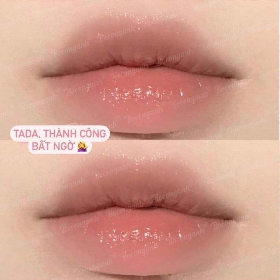 Dưỡng môi Mediheal Labocare Pan+ Eno Lips