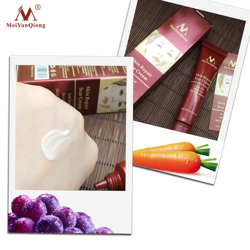 MeiYanQiong Acne Scar Removal Cream Skin Repair Stretch Marks 15ml | BigBuy360 - bigbuy360.vn