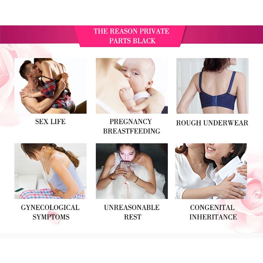 Kem Làm Trắng Hồng Da Vùng Dưới Cánh Tay/Vùng Kín/Vùng Kín Cho Nữ