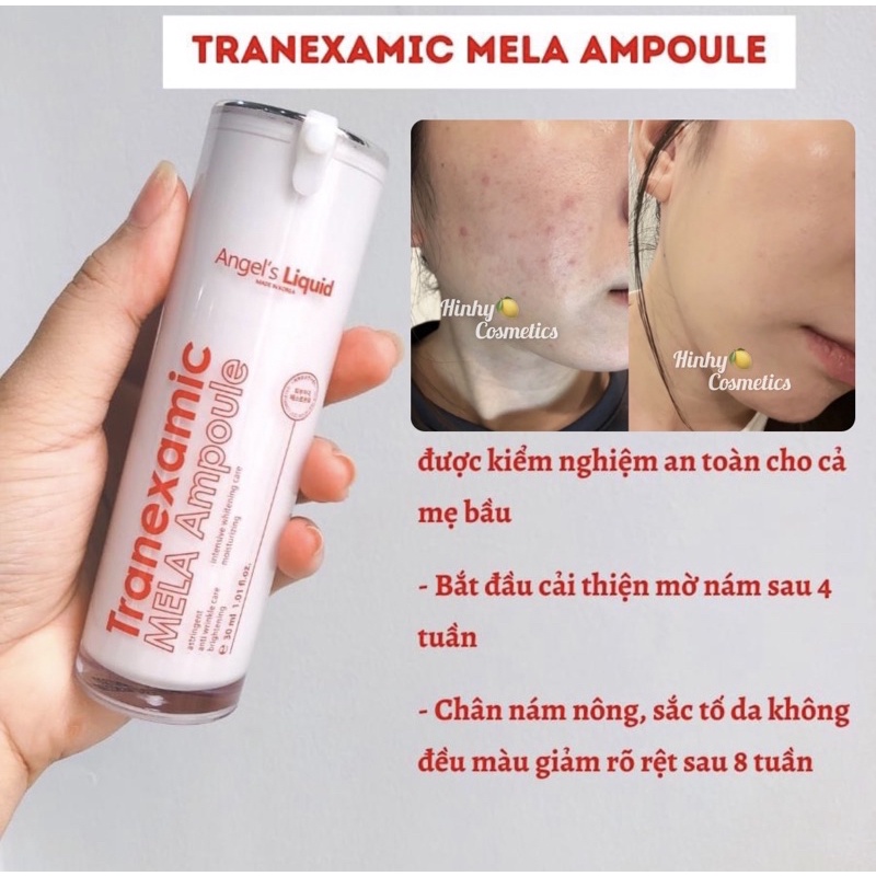 Siêu Tinh Chất Giảm Thâm Đỏ Mờ Sạm Nám Angel's Liquid Tranexamic 30ml