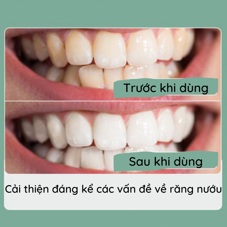 ✈️ [Freeship] Máy Tăm Nước, Tăm Nước Cầm Tay Vệ Sinh Răng Miệng JUST FOR Better Space