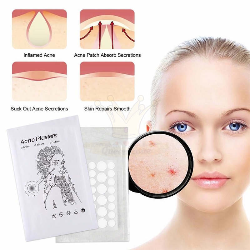 Set 36 Miếng Dán Hỗ Trợ Giảm Mụn Vô Hình Tiện Dụng Miếng Dán Hỗ Trợ Cải Thiện Mụn Kiểm Soát Dầu Không Thấm Nước