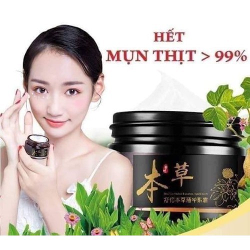 Kem đánh bay mụn thit đông y_ chuẩn