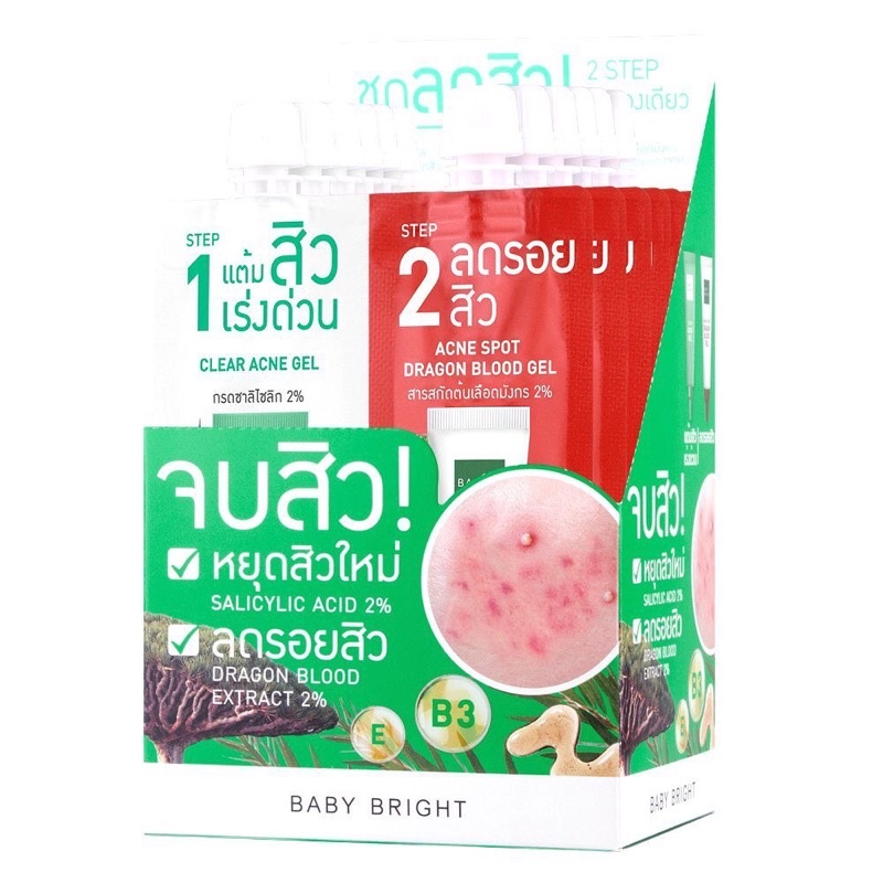 Set Loại Bỏ Mụn Cấp Tốc 2 In 1 Clear & Treat Acne Set Baby Brigh Thái Lan