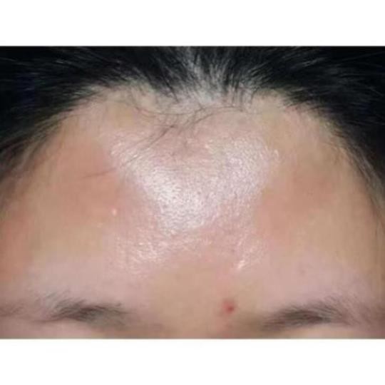 [HÀNG SẴN]B-tox Peel 2 MÀU Powder &amp; Solution chính hãng 1 hộp 6 cặp