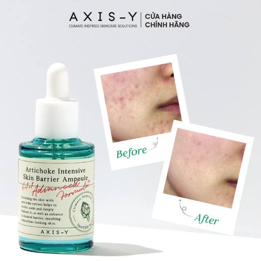 Tinh chất phục hồi da Axis-Y Artichoke Intensive Skin Barrier Ampoule 30ml