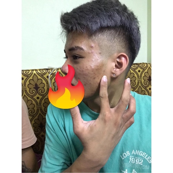 Serum thảo dược dr.skinacnes