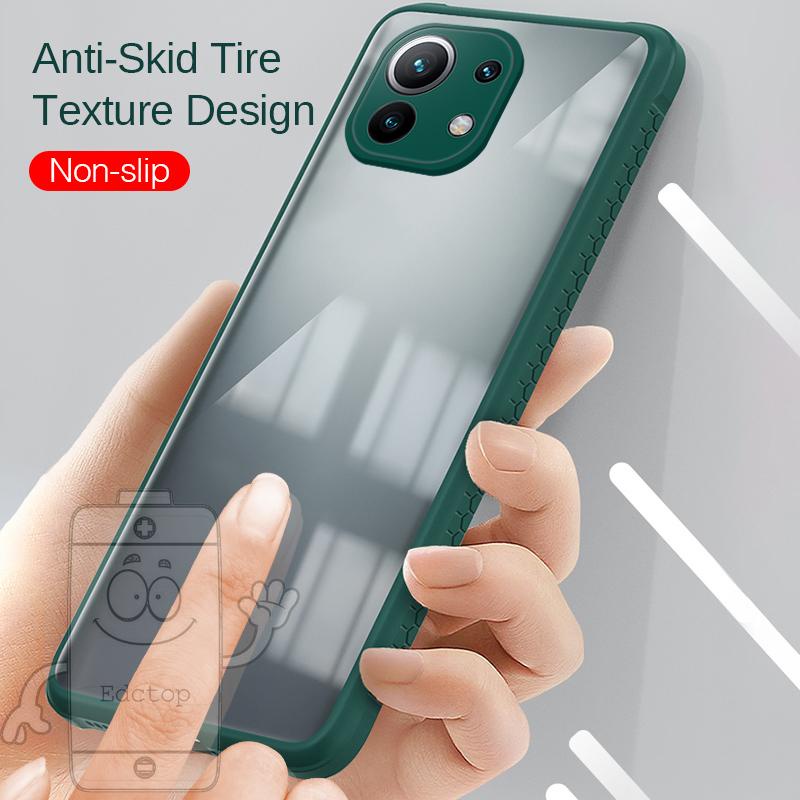 Silicone Hard Case Oneplus 9 Pro 8T Nord N100 4G Protection Cover Shockproof Cases