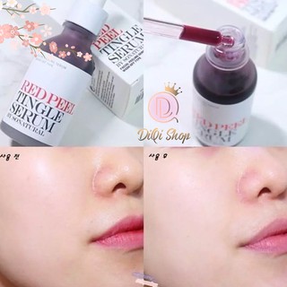 Tinh chất dưỡng da Red