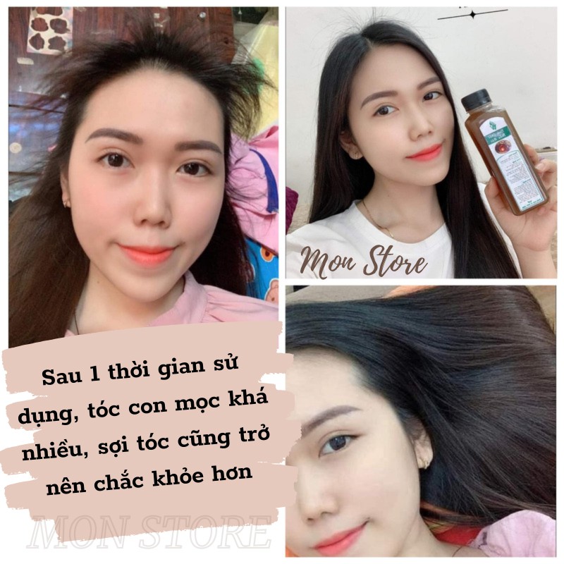 [Tặng kèm chai pha] TINH CHẤT THẢO MỘC VV Natural Cosmetic kích thích mọc tóc, ngăn rụng, giảm gàu nấm ngứa