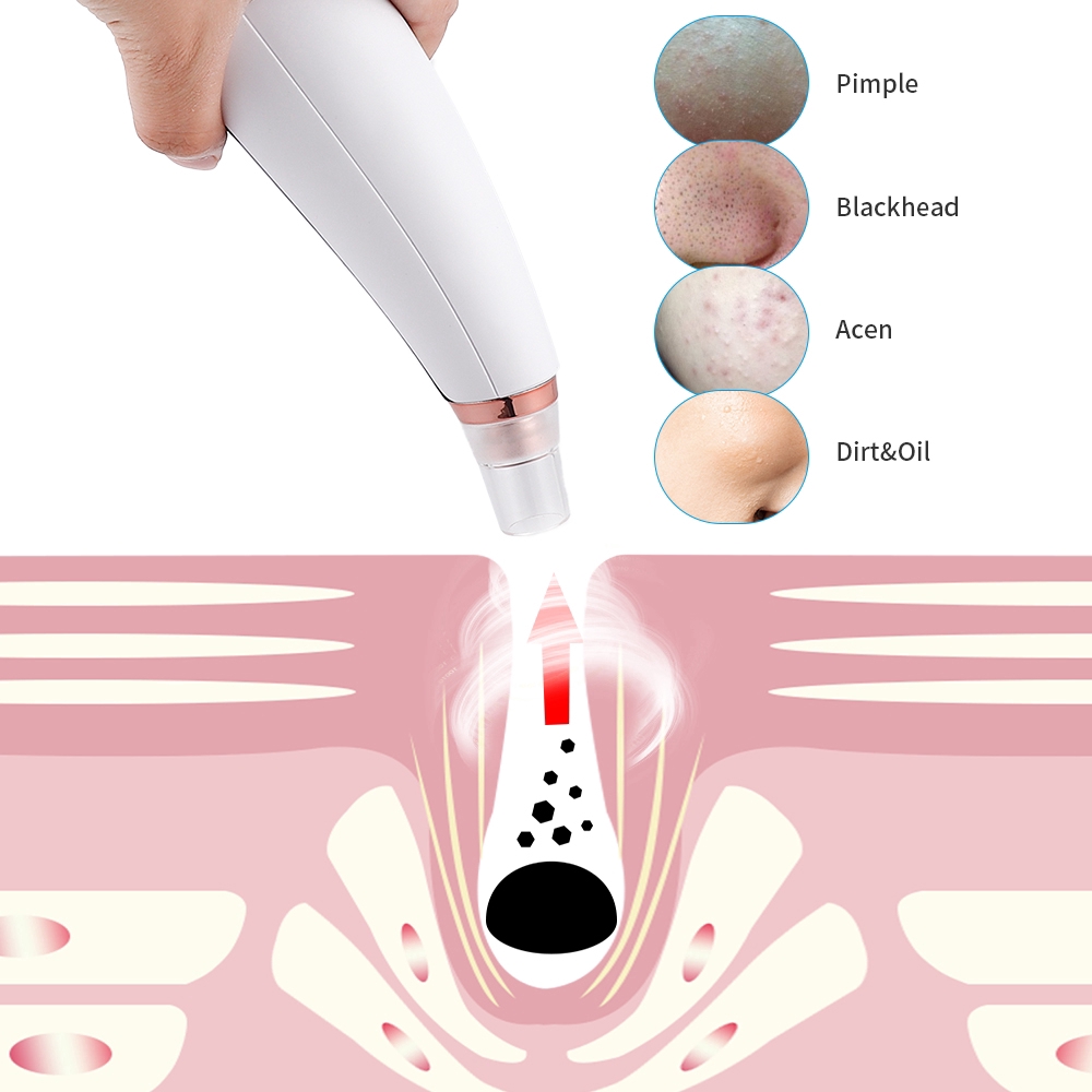 Cổ Phiếu Sẵn Sàng | Máy Hút Mụn Đầu Đen Làm Sạch Sâu Lỗ Chân Lông Chăm Sóc Da Mặt Cổng Usb